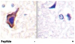 GRIN1 Rabbit anti-Human, Mouse, Rat, Polyclonal Antibody, Abnova 100&mu;g;