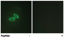 GRIN1 Rabbit anti-Human, Mouse, Rat, Polyclonal Antibody, Abnova 100&mu;g;