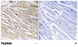 PEA15 Rabbit anti-Human, Mouse, Rat, Polyclonal Antibody, Abnova 100 &mu;g | Buy Online | Abnova Corporation | Fisher Scientific