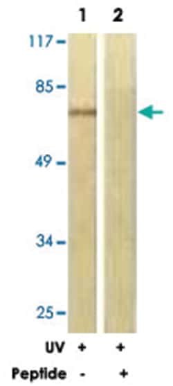 PRKCA Rabbit anti-Human, Mouse, Rat, Polyclonal Antibody, Abnova 100&mu;g;