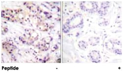 PRKCA Rabbit anti-Human, Mouse, Rat, Polyclonal Antibody, Abnova 100&mu;g;