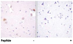 PLD1, Rabbit, Polyclonal Antibody, Abnova 100&mu;g; Unlabeled:Antibodies,