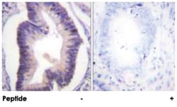 PFKFB2 Rabbit anti-Human, Mouse, Rat, Polyclonal Antibody, Abnova 100&mu;g;