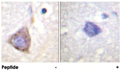 BCR Rabbit anti-Human, Mouse, Polyclonal Antibody, Abnova 100&mu;g; Unlabeled:Antibodies,