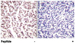 BLM Rabbit anti-Human, Polyclonal Antibody, Abnova 100 &mu;g | Buy Online | Abnova | Fisher Scientific