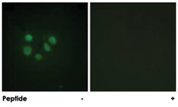BLM Rabbit anti-Human, Polyclonal Antibody, Abnova 100 &mu;g | Buy Online | Abnova | Fisher Scientific