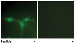 PTK6 Rabbit anti-Human, Polyclonal Antibody, Abnova 100&mu;g; Unlabeled:Antibodies,