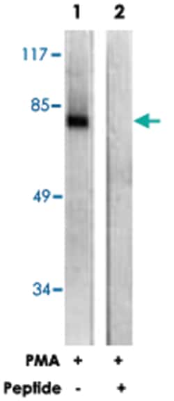 PRKCZ Rabbit anti-Human, Mouse, Rat, Polyclonal Antibody, Abnova 100μg;