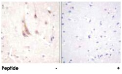 PRKCZ Rabbit anti-Human, Mouse, Rat, Polyclonal Antibody, Abnova 100μg;