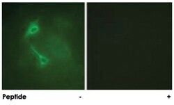 PRKCZ Rabbit anti-Human, Mouse, Rat, Polyclonal Antibody, Abnova 100μg;