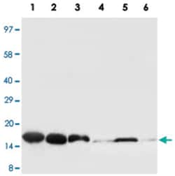 SOD1 Rabbit anti-Human, Mouse, Rat, Polyclonal Antibody, Abnova 100&mu;g;