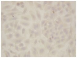 SOD1 Rabbit anti-Human, Mouse, Rat, Polyclonal Antibody, Abnova 100&mu;g;