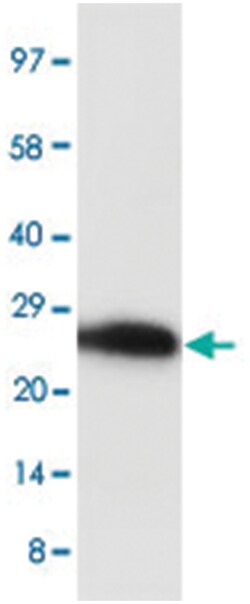 SA-P, Rabbit, Polyclonal Antibody, Abnova 100&mu;g; Unlabeled:Antibodies,