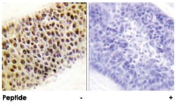 KAT5 Rabbit anti-Human, Mouse, Polyclonal Antibody, Abnova 100&mu;g; Unlabeled:Antibodies,