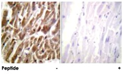 TNNI3 Rabbit anti-Human, Mouse, Rat, Polyclonal Antibody, Abnova 100 &mu;g | Buy Online | Abnova | Fisher Scientific