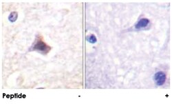 CEBPE Rabbit anti-Human, Polyclonal Antibody, Abnova 100&mu;g; Unlabeled:Antibodies,