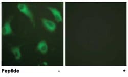 C5AR1 Rabbit anti-Human, Polyclonal Antibody, Abnova 100&mu;g; Unlabeled:Antibodies,