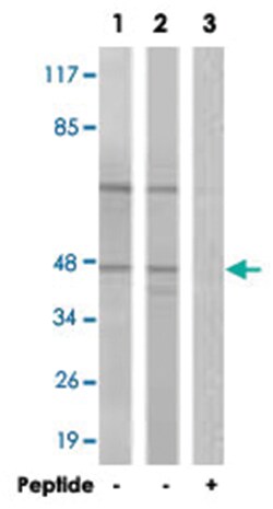 CCNE2 Rabbit anti-Human, Mouse, Polyclonal Antibody, Abnova 100 &mu;g | Buy Online | Abnova Corporation | Fisher Scientific