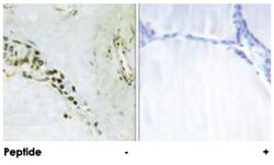 CCNE2 Rabbit anti-Human, Mouse, Polyclonal Antibody, Abnova 100 &mu;g | Buy Online | Abnova Corporation | Fisher Scientific
