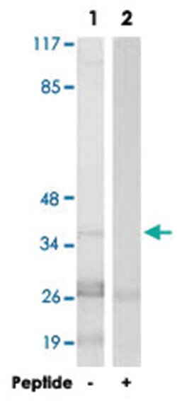 CCNH, Rabbit, Polyclonal Antibody, Abnova 100&mu;g; Unlabeled:Antibodies,