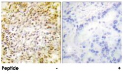 CCNH, Rabbit, Polyclonal Antibody, Abnova 100&mu;g; Unlabeled:Antibodies,