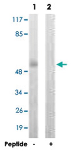 DAPK3 Rabbit anti-Human, Mouse, Rat, Polyclonal Antibody, Abnova 100&mu;g;