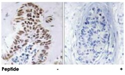 DAPK3 Rabbit anti-Human, Mouse, Rat, Polyclonal Antibody, Abnova 100&mu;g;
