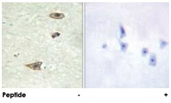 GRK1 Rabbit anti-Human, Mouse, Rat, Polyclonal Antibody, Abnova 100&mu;g;