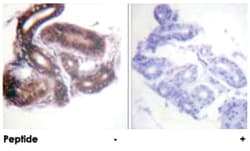 HDAC3 Rabbit anti-Human, Mouse, Rat, Polyclonal Antibody, Abnova 100&mu;g;