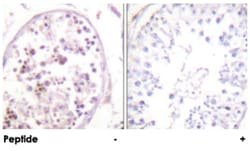 HDAC6 Rabbit anti-Human, Mouse, Polyclonal Antibody, Abnova 100 &mu;g | Buy Online | Abnova | Fisher Scientific
