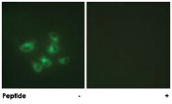 TPH1 Rabbit anti-Human, Mouse, Rat, Polyclonal Antibody, Abnova 100 &mu;g | Buy Online | Abnova Corporation | Fisher Scientific
