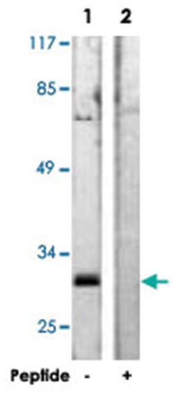 KCNIP3 Rabbit anti-Human, Mouse, Polyclonal Antibody, Abnova 100&mu;g;