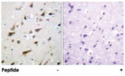 KCNIP3 Rabbit anti-Human, Mouse, Polyclonal Antibody, Abnova 100&mu;g;