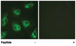 KCNIP3 Rabbit anti-Human, Mouse, Polyclonal Antibody, Abnova 100&mu;g;