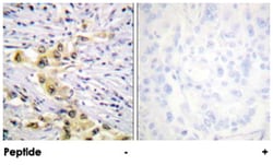 IGF2R Rabbit anti-Human, Mouse, Rat, Polyclonal Antibody, Abnova 100&mu;g;