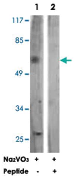 IL10RA Rabbit anti-Human, Polyclonal Antibody, Abnova 100&mu;g; Unlabeled:Antibodies,