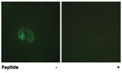 IL10RA Rabbit anti-Human, Polyclonal Antibody, Abnova 100&mu;g; Unlabeled:Antibodies,