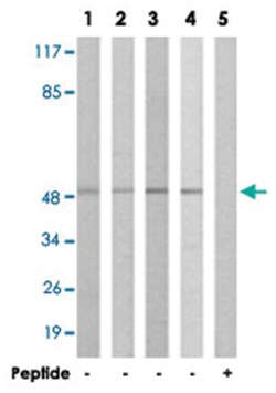 IL13RA1, Rabbit, Polyclonal Antibody, Abnova 100 &mu;g | Buy Online | Abnova | Fisher Scientific