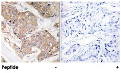 IL13RA1, Rabbit, Polyclonal Antibody, Abnova 100 &mu;g | Buy Online | Abnova | Fisher Scientific