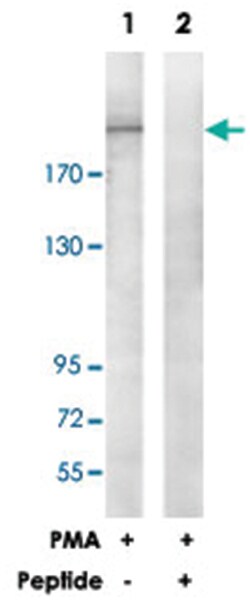 ITGB4 Rabbit anti-Human, Mouse, Rat, Polyclonal Antibody, Abnova 100&mu;g;