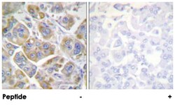 ITGB4 Rabbit anti-Human, Mouse, Rat, Polyclonal Antibody, Abnova 100&mu;g;