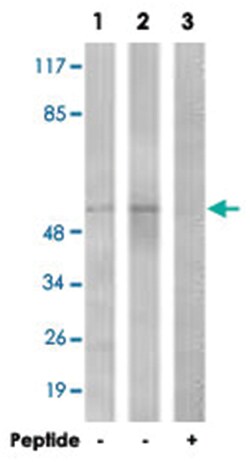 TGFBR1 Rabbit anti-Human, Mouse, Rat, Polyclonal Antibody, Abnova 100 &mu;g | Buy Online | Abnova Corporation | Fisher Scientific