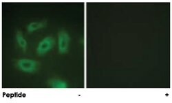 TGFBR1 Rabbit anti-Human, Mouse, Rat, Polyclonal Antibody, Abnova 100 &mu;g | Buy Online | Abnova Corporation | Fisher Scientific