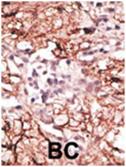 Aof 2 Rabbit anti-Human, Mouse, Polyclonal Antibody, Abnova 400&mu;L; Unlabeled:Antibodies,