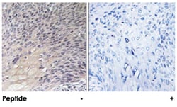 ARHGDIA, Rabbit, Polyclonal Antibody, Abnova 100&mu;g; Unlabeled:Antibodies,