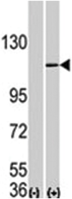 Aof 2 Rabbit anti-Human, Polyclonal Antibody, Abnova 400 &mu;L | Buy Online | Abnova | Fisher Scientific