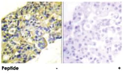 PIK3R1/PIK3R3 Rabbit anti-Human, Mouse, Rat, Polyclonal Antibody, Abnova