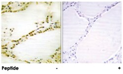 RGS16, Rabbit, Polyclonal Antibody, Abnova 100&mu;g; Unlabeled:Antibodies,