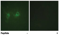 RGS16, Rabbit, Polyclonal Antibody, Abnova 100&mu;g; Unlabeled:Antibodies,