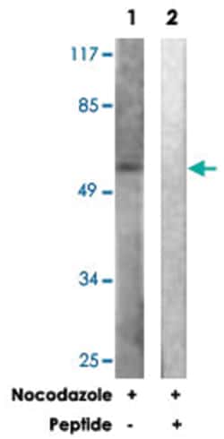 VIM Rabbit anti-Human, Polyclonal Antibody, Abnova 100&mu;g; Unlabeled:Antibodies,